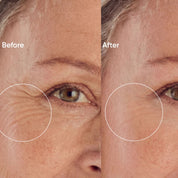 Smoothing Face Bundle Forehead + Eyes