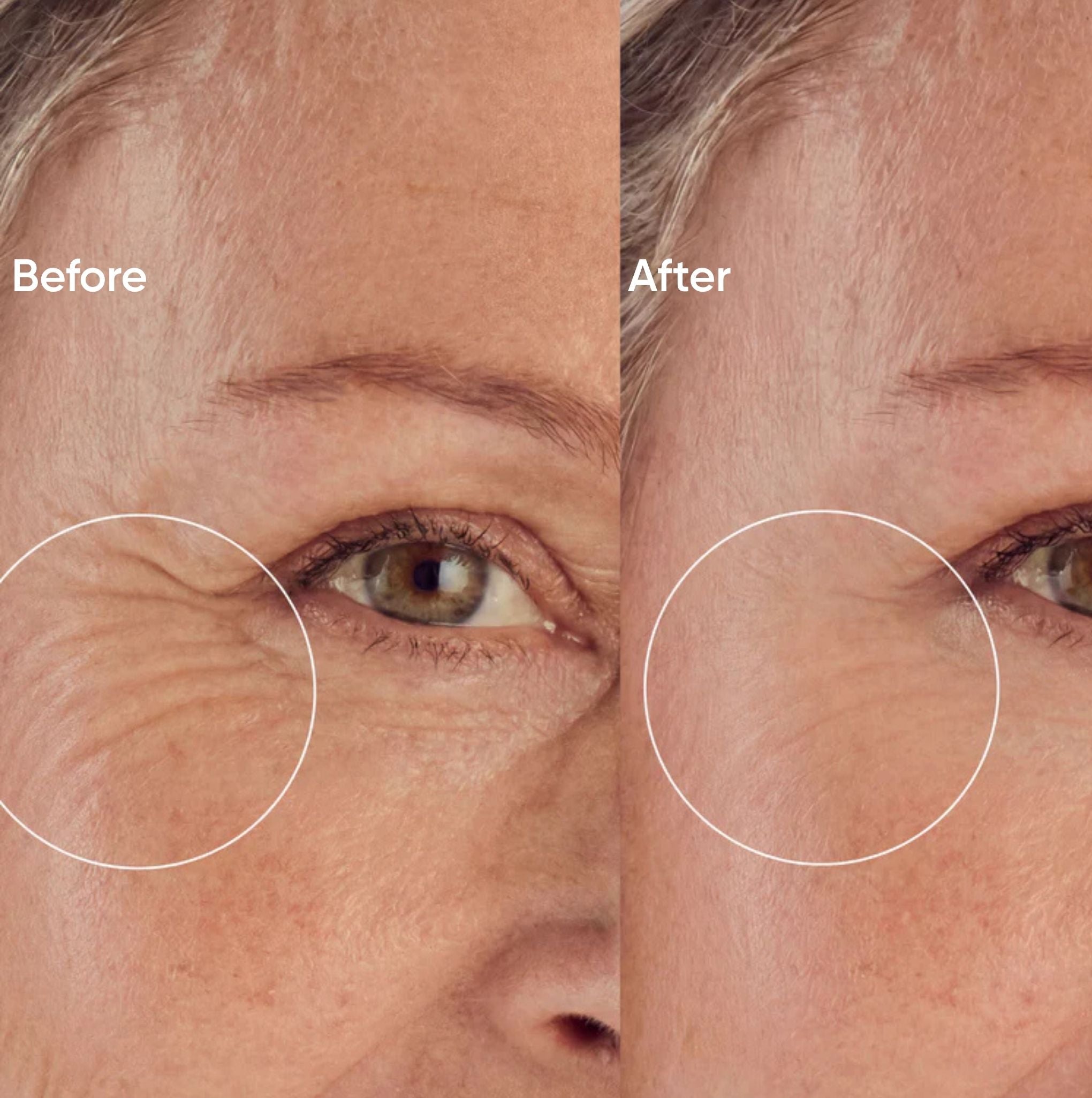 Smoothing Face Bundle Forehead + Eyes