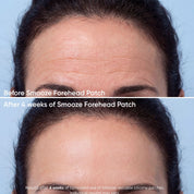 Smoothing Face Bundle Forehead + Eyes