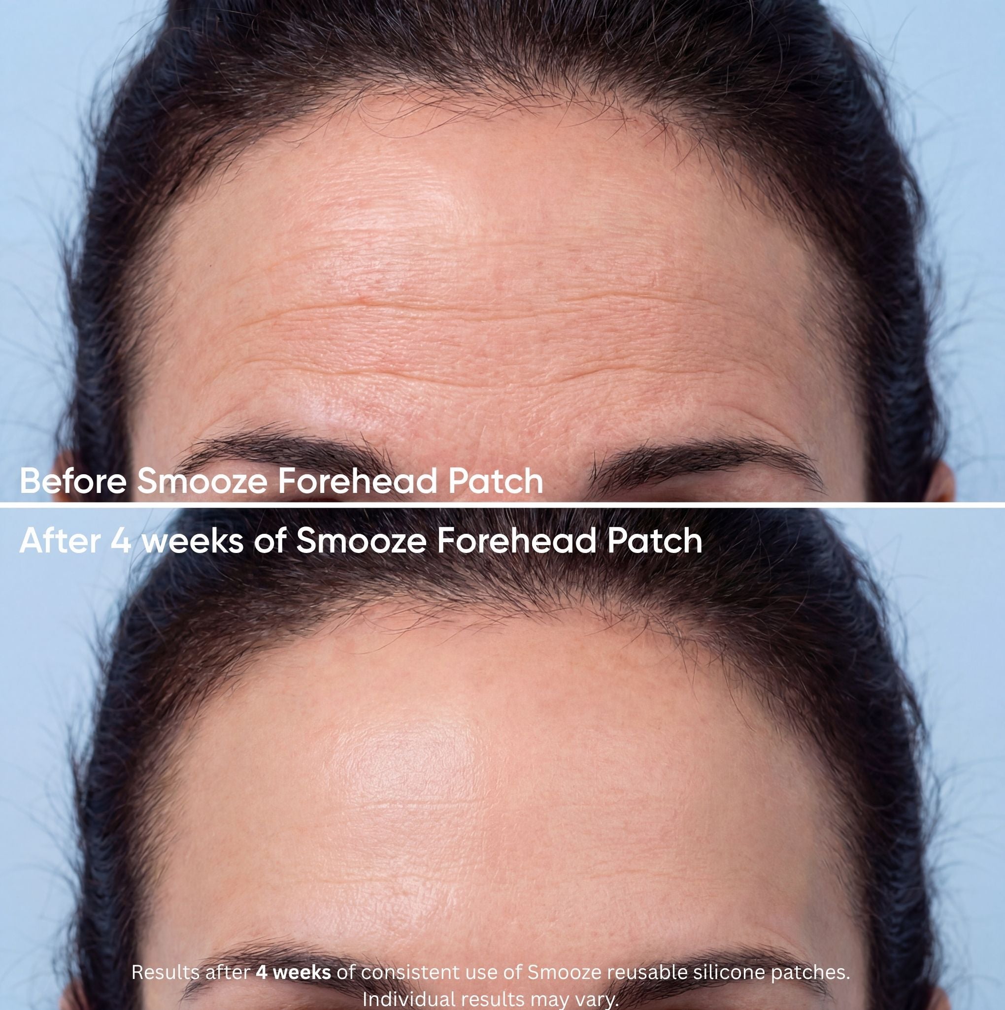 Smoothing Face Bundle Forehead + Eyes
