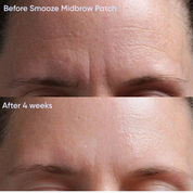 Reusable Mid Brow Lift Patch x2