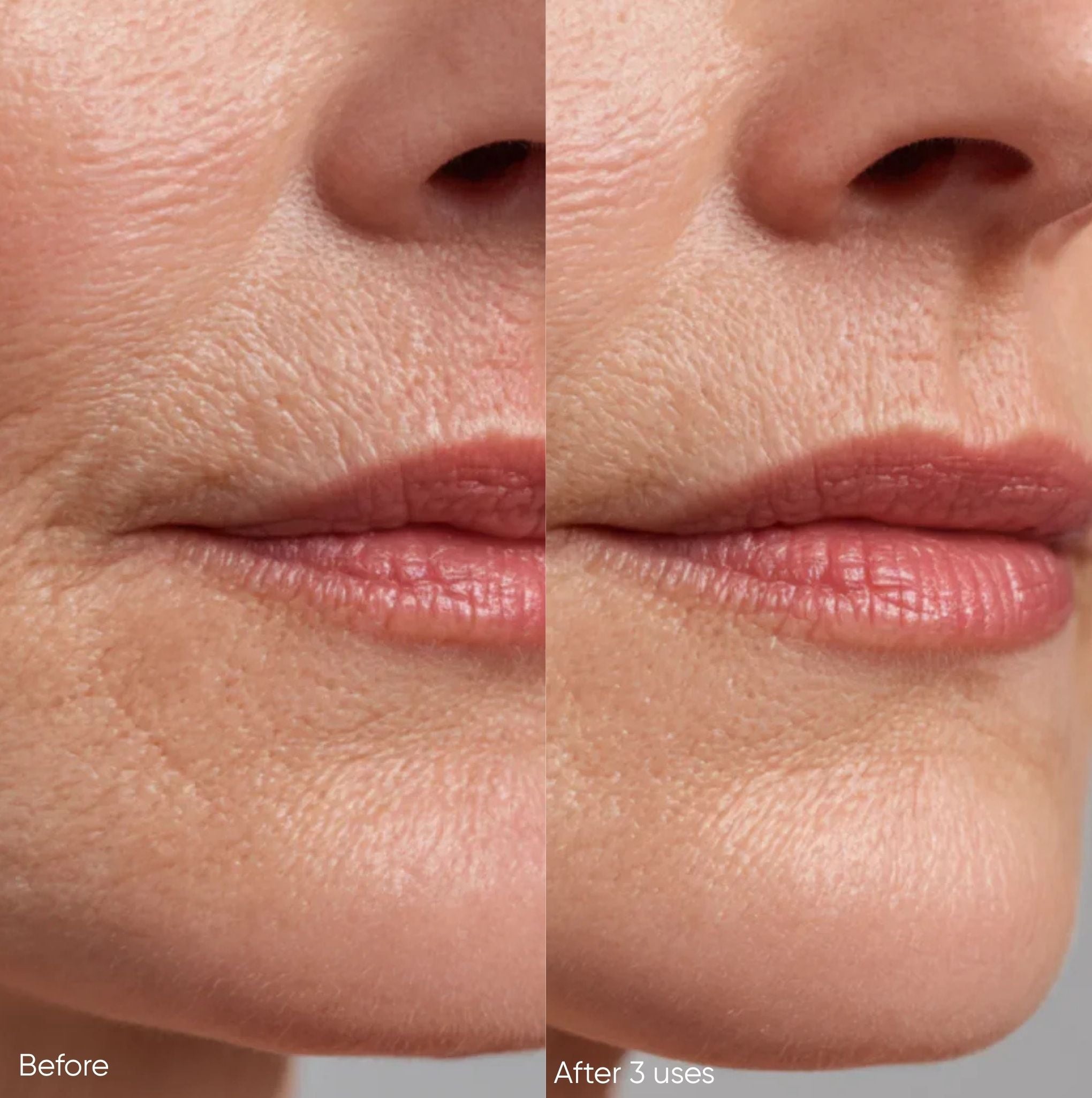 Reusable Mouth Patches