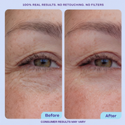 Reusable Eye Wrinkle Smoothing Patches