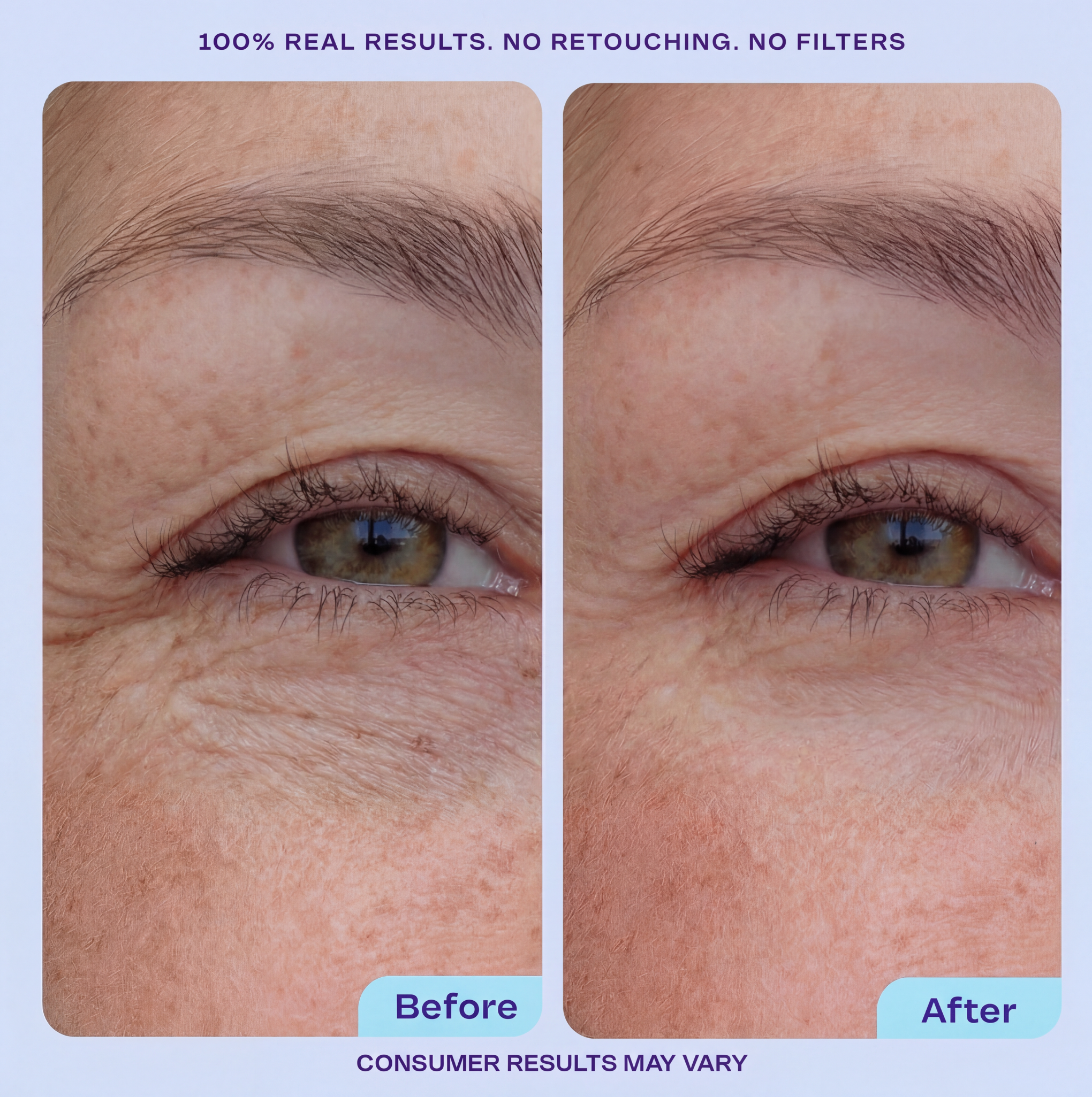 Reusable Eye Wrinkle Smoothing Patches